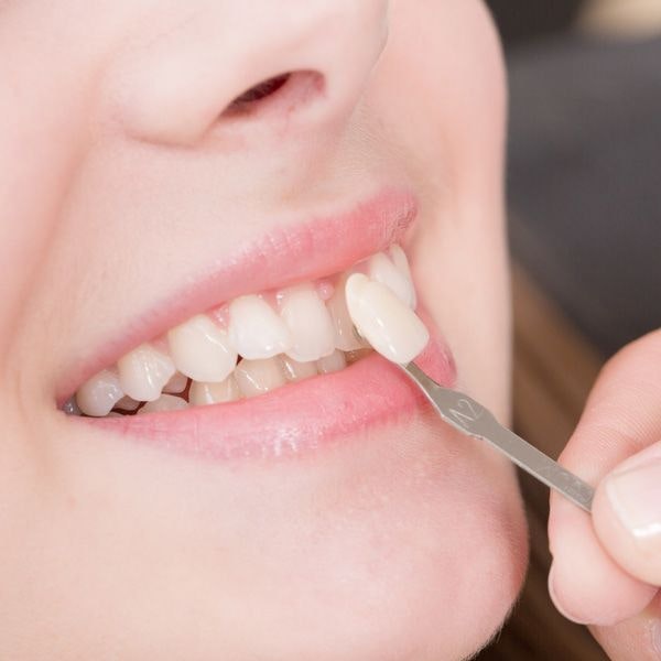 Close up of woman receiving a veneer