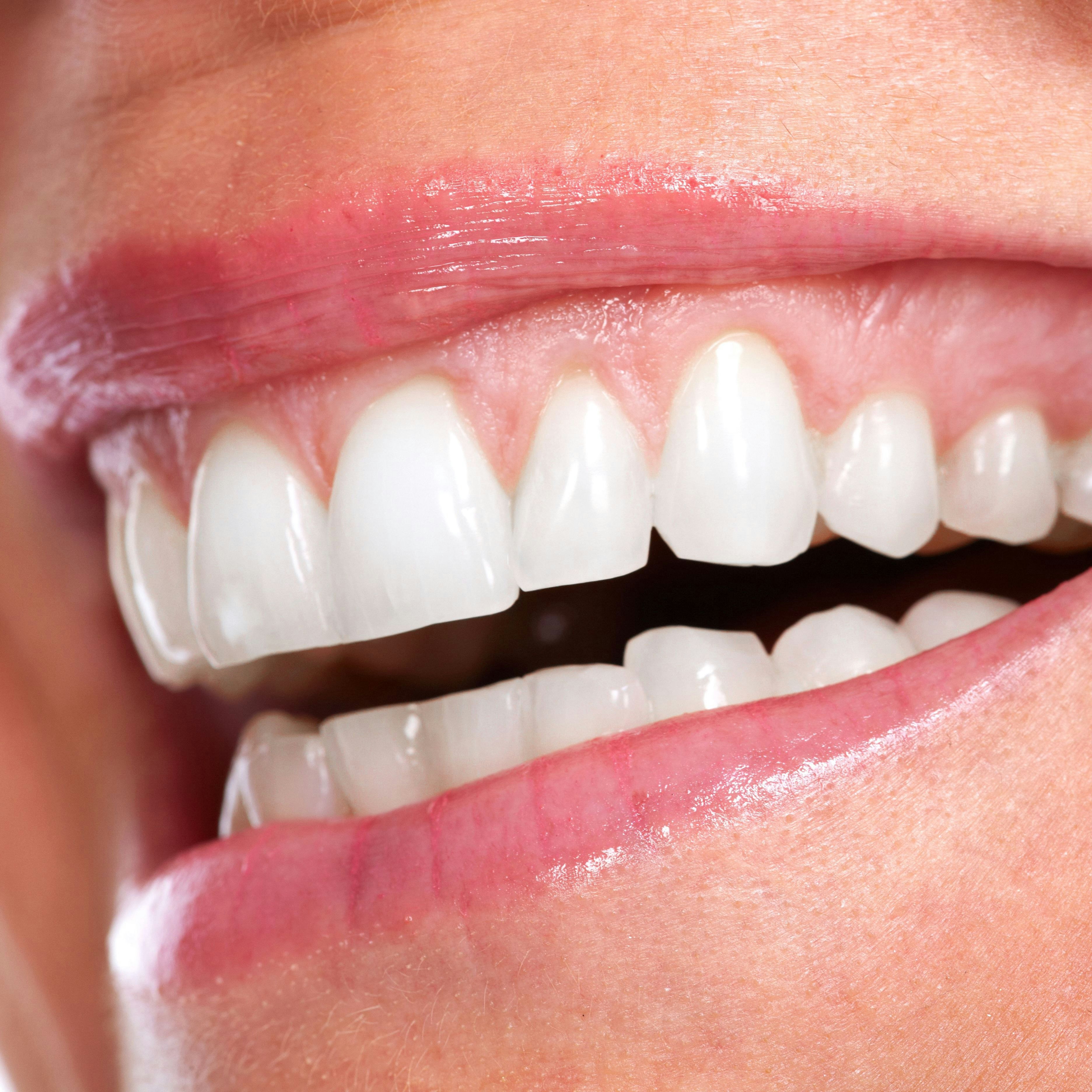 Close up of uneven gum line