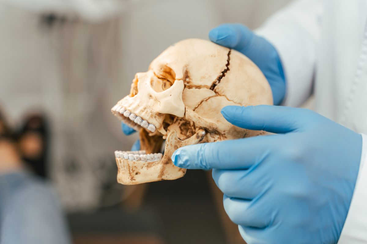 Patient with improved jaw function after MARPE
