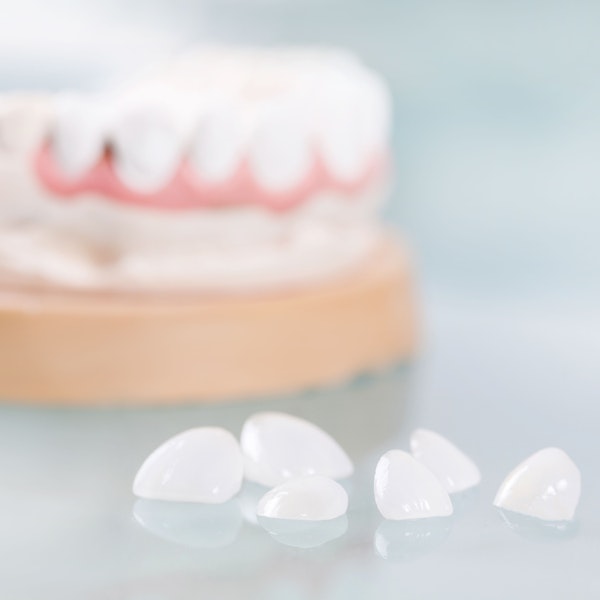 e.maxÂ® veneers
