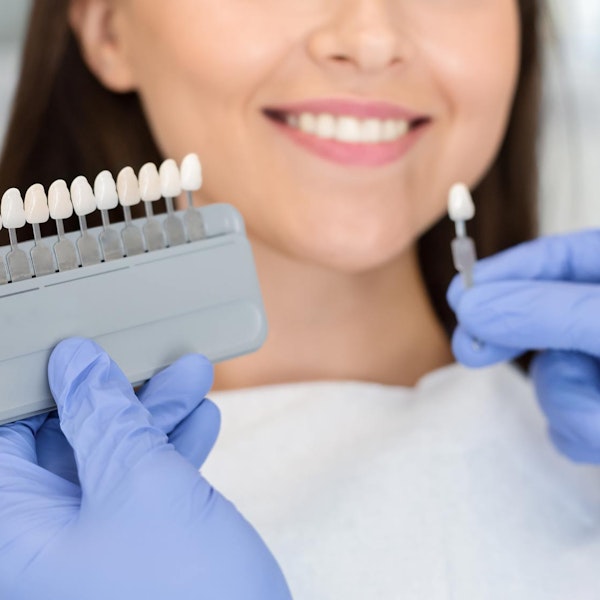 Woman comparing different veneer shades at the dentist's office
