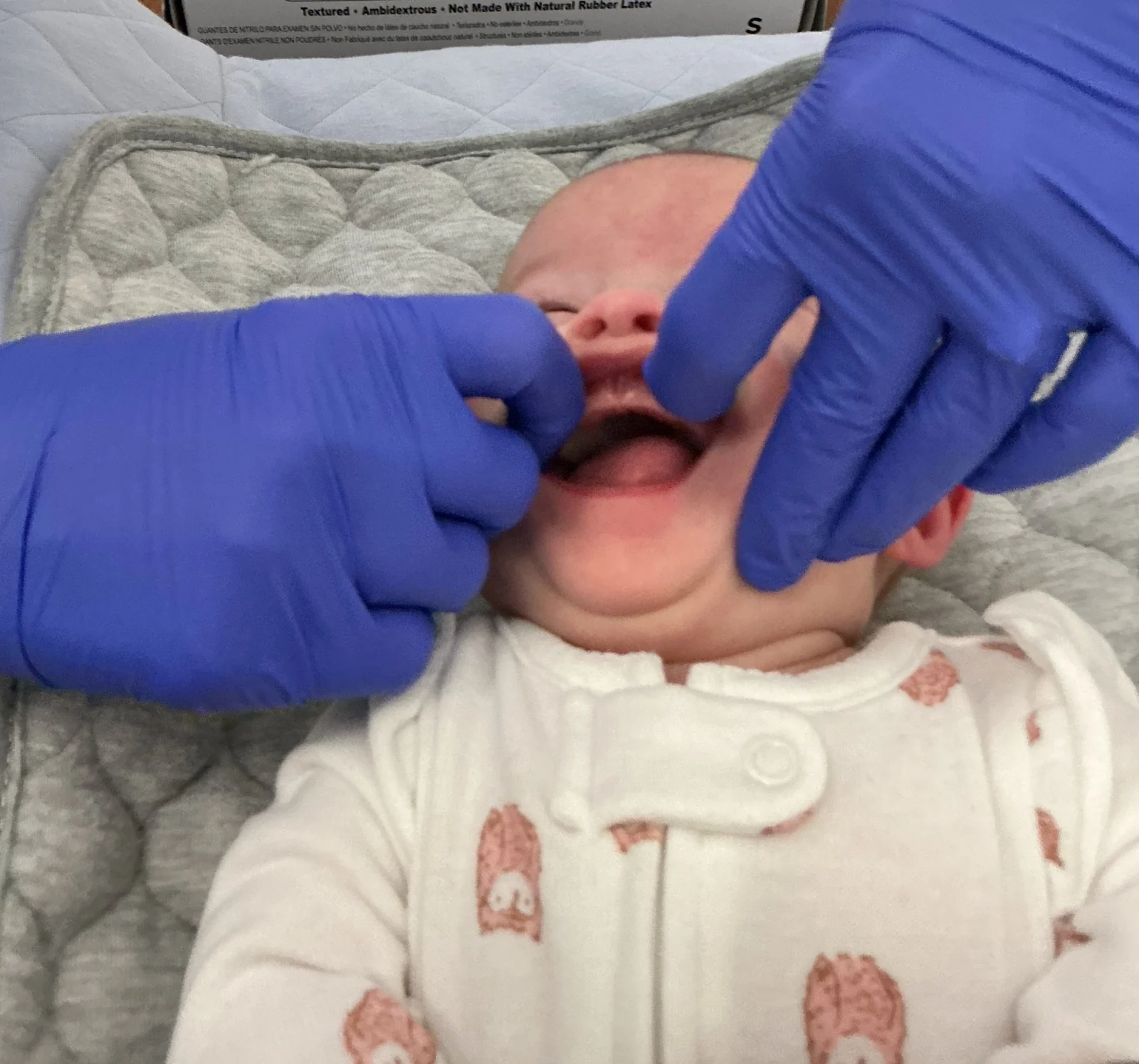 An infant receiving an oral examination at Peak Family Dentistry